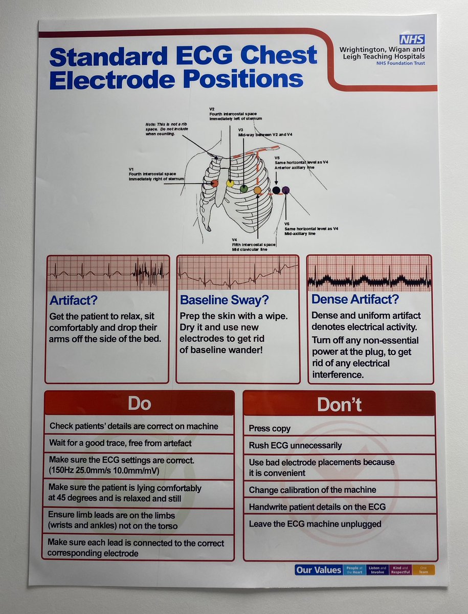 Helen Titu (@titu_helen) on Twitter photo Guidance on the importance of correct recording & electrode placement
Doโs โ๏ธ& Donโts โ ๐ซ
displayed on posters <a href="/wwl_ecc/">WWL EMERGENCY CARE ๐</a> <a href="/wwl_cardiology/">WWL_CARDIOLOGY</a>. Thank you to our cardiology physiologists for putting together โบ๏ธ <a href="/Amandaahmed2/">Amanda ahmed</a> <a href="/Kim_Whiteside/">Kim Whiteside</a> <a href="/GemBurrows/">Gemma Burrows</a> <a href="/murph_bongo/">Alison Murphy</a> ๐ #PatientSafety Guidance on the importance of correct recording & electrode placement
Doโs โ๏ธ& Donโts โ ๐ซ
displayed on posters <a href="/wwl_ecc/">WWL EMERGENCY CARE ๐</a> <a href="/wwl_cardiology/">WWL_CARDIOLOGY</a>. Thank you to our cardiology physiologists for putting together โบ๏ธ <a href="/Amandaahmed2/">Amanda ahmed</a> <a href="/Kim_Whiteside/">Kim Whiteside</a> <a href="/GemBurrows/">Gemma Burrows</a> <a href="/murph_bongo/">Alison Murphy</a> ๐ #PatientSafety