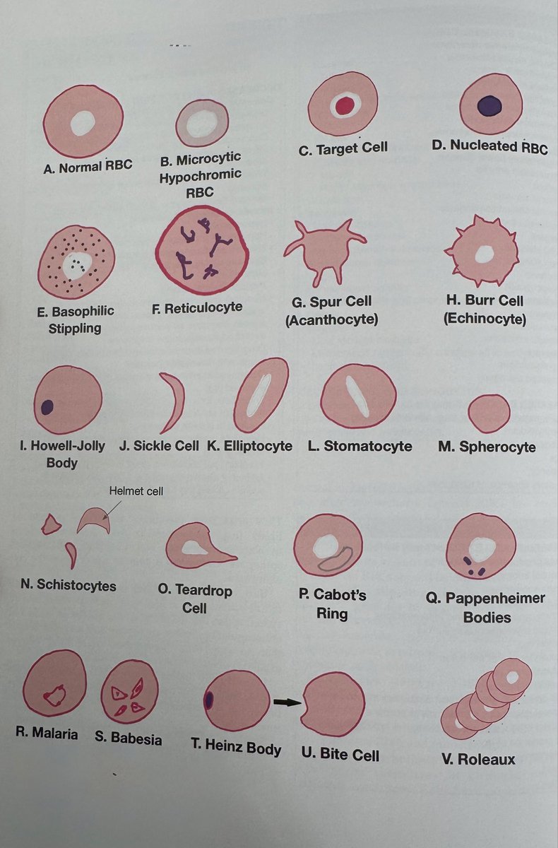 OGdukeneurosurg's tweet photo. Atypical red blood cells… what is most serious? https://t.co/JjGbNY7Vgx