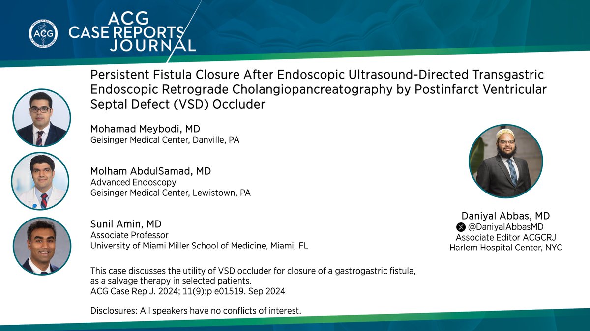 ACGCRJ (@acgcrj) on Twitter photo ⏰ for #ACGCRJ Tweetorial🧵 w/<a href="/DaniyalAbbasMD/">Daniyal Abbas</a>
👉Persistent Fistula Closure After EDGE with Postinfarct VSD Occluder
🎧Podcast bit.ly/3ymjTvy
📚Article bit.ly/3BSUueq
🙏<a href="/MeybodiMohamad/">Mohamad Aghaie Meybodi, MD</a> <a href="/SunilAminMD/">Sunil Amin, MD, FASGE, FRCPC</a>
<a href="/AmCollegeGastro/">ACG</a> <a href="/NadeemYousafMD/">Nadeem Yousaf</a> <a href="/PrateekHarne1/">Prateek Harne MBBS, MD</a> #GITwitter ⏰ for #ACGCRJ Tweetorial🧵 w/<a href="/DaniyalAbbasMD/">Daniyal Abbas</a>
👉Persistent Fistula Closure After EDGE with Postinfarct VSD Occluder
🎧Podcast bit.ly/3ymjTvy
📚Article bit.ly/3BSUueq
🙏<a href="/MeybodiMohamad/">Mohamad Aghaie Meybodi, MD</a> <a href="/SunilAminMD/">Sunil Amin, MD, FASGE, FRCPC</a>
<a href="/AmCollegeGastro/">ACG</a> <a href="/NadeemYousafMD/">Nadeem Yousaf</a> <a href="/PrateekHarne1/">Prateek Harne MBBS, MD</a> #GITwitter