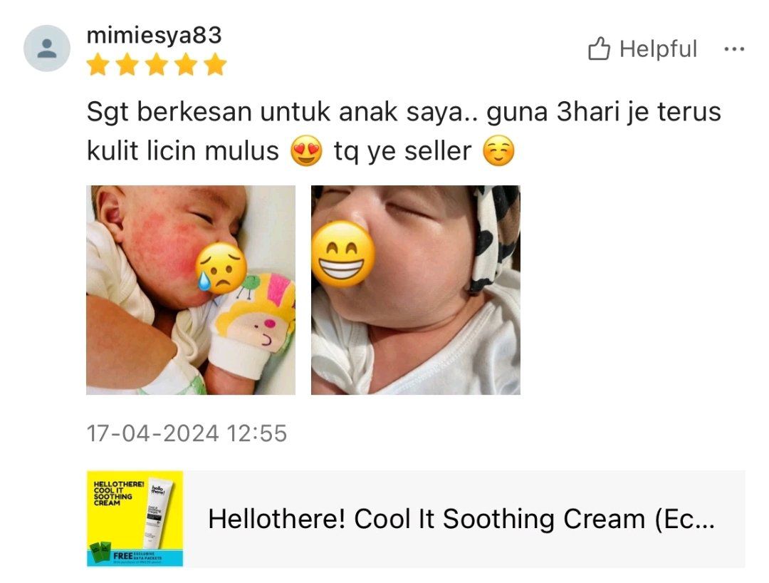 Soothing cream ini fokus kepada eczema, psoriasis dan juga kegatalan.

Alhamdulillah ramai ibubapa yang berpuashati selepas menggunakan soothing cream &amp; moisturizer ini

Soothing s.shopee.com.my/6KoF3iwoGG
Combo s.shopee.com.my/2Ayg67CDSy