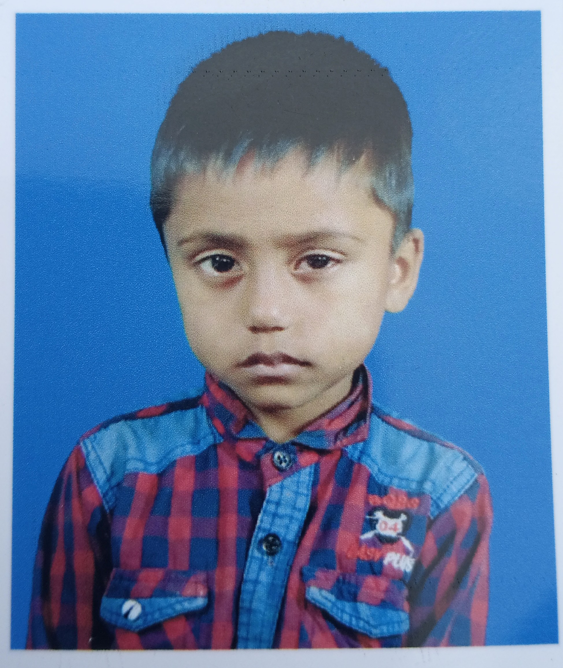 সরিষাবাড়ীর শিশু ইউনুসকে বাঁচাতে এগিয়ে আসুন