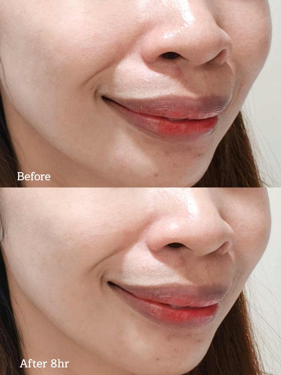 กันแดดตัวใหม่ของ Skintific คือปังมากกกก เป็นสูตรแมตต์ที่เนื้อเบามากๆเนียนไปกับผิวเลยอะ คุมมัน 12 ชั่วโมง นี่ผ่านไป 8 ชั่วโมงละหน้ายังไม่มันเลยอะ ทำถึงเกินนน มีส่วนผสมของ Zinc PCA และ Fomes officinalis ชุ่มชื้นดีมาก ใช้เตรียมผิวก่อนแต่งหน้าคือเริ่ด  #ใช้ดีบอกต่อ https://t.co/s9G23dPSwD