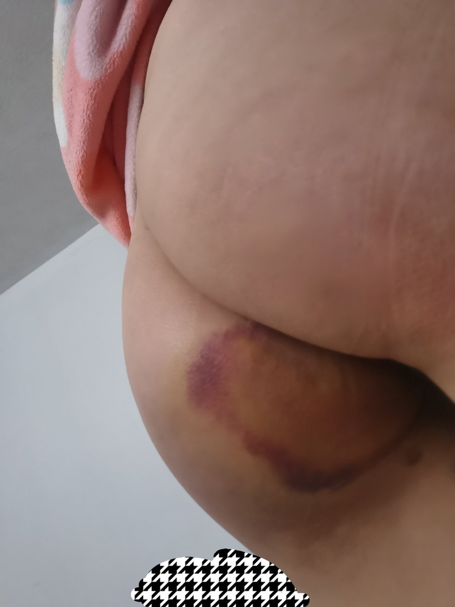 转型成为翘臀博主✌🏻
#翘臀