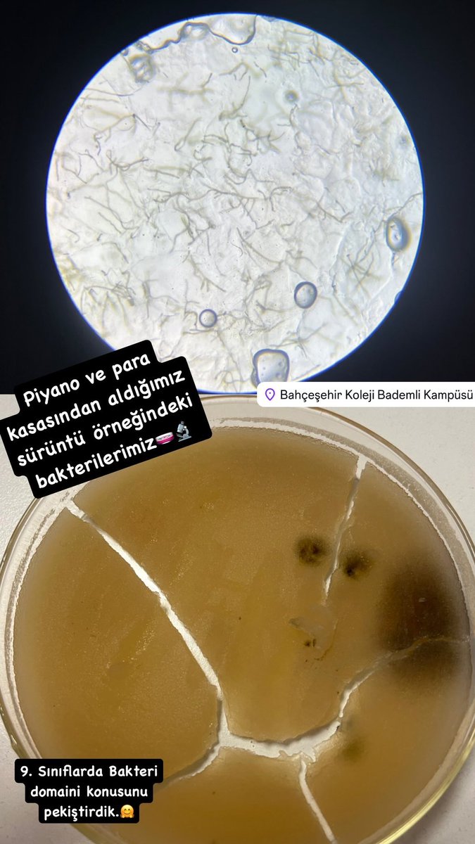 Eda Başaran BK (@edabiyo) on Twitter photo 🧫🔬9.sınıflarımızla ektiğimiz bakterilerimiz üredi ve mikroskoptan fotoğraf çekmeyi öğrendiler.🧫🔬 #bakteri #domain #maarif #bursabademlibk <a href="/demirkemal08/">kemal demir</a> <a href="/mehvespamukcuu/">MEHVEŞ PAMUKÇU</a> <a href="/mustafakaskaval/">Mustafa Kaşkaval</a> <a href="/TumaySen/">Tümay Şen</a> <a href="/SenemGkta3/">Senem Göktaş</a> 🧫🔬9.sınıflarımızla ektiğimiz bakterilerimiz üredi ve mikroskoptan fotoğraf çekmeyi öğrendiler.🧫🔬 #bakteri #domain #maarif #bursabademlibk <a href="/demirkemal08/">kemal demir</a> <a href="/mehvespamukcuu/">MEHVEŞ PAMUKÇU</a> <a href="/mustafakaskaval/">Mustafa Kaşkaval</a> <a href="/TumaySen/">Tümay Şen</a> <a href="/SenemGkta3/">Senem Göktaş</a>