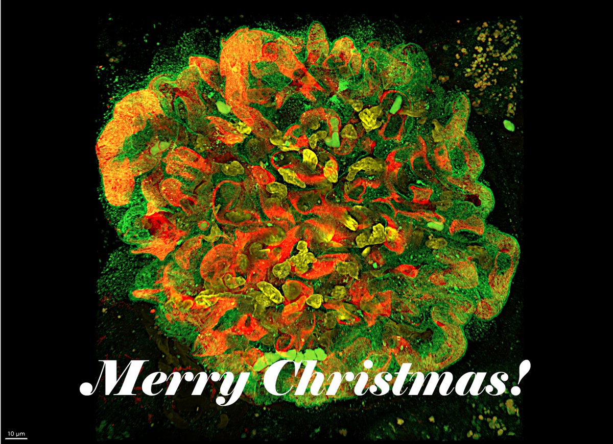 jeieiouti's tweet photo. Merry Christmas!

Fluorescent image:
🟢Nephrin ~ green leaf
🔴Endothelial cells ~ red ribbon
🟡DAPI ~ gold jingle bells

#Fluorescence_microscopy
#Podocytes https://t.co/crMPz4NIIr