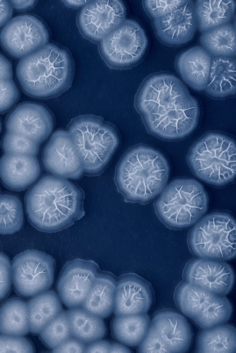 ukbiofilms's tweet image. 🔬Our #ResearchInFocus blog series highlights the diverse #research taking place across our #biofilm network - from safeguarding water quality for the future to using microbial #biofilms to generate electricity! 

👩🏻‍🔬Take a look 🔎 tinyurl.com/4r8v8uj7

#science #scicomm #AMR
