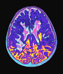 MindBodyIsLife's tweet photo. Tu cerebro está frito.

Olvidas el 90 % de lo que estudias porque no entiendes cómo funciona la memoria.

Descubrí el protocolo de 3 pasos de Andrew Huberman para reprogramar tu cerebro y absorber todo lo que lees.

Así es como puedes usarlo:🧵 https://t.co/zZ3kAaBnGk