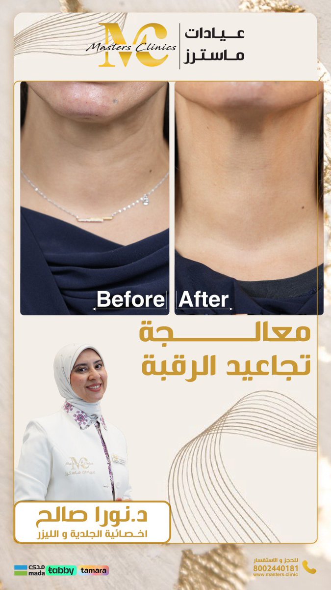 عيادات ماسترز ✅ خبراء لصحتك و جمالك

.

للتواصل وللحجز الآن

0553777386

مع إمكانية التقسيط علي دفعات بدون فوائد وبدون رسوم

#masters_clinic
#عيادات_ماستر #اسنان #جده_lلان #مكه_الان #مكة_المكرمة 
#نضارة #بشرة #جمال #تفتيح #شد_البشرة #تجميل