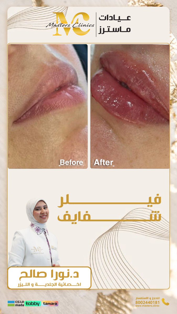 عيادات ماسترز ✅ خبراء لصحتك و جمالك

.

للتواصل وللحجز الآن

0553777386

مع إمكانية التقسيط علي دفعات بدون فوائد وبدون رسوم

#masters_clinic
#عيادات_ماستر #اسنان #جده_lلان #مكه_الان #مكة_المكرمة 
#نضارة #بشرة #جمال #تفتيح #شد_البشرة #تجميل