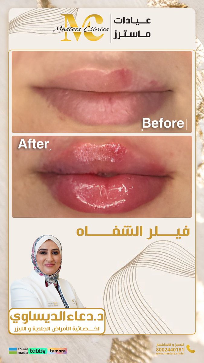 عيادات ماسترز ✅ خبراء لصحتك و جمالك

.

للتواصل وللحجز الآن

0553777386

مع إمكانية التقسيط علي دفعات بدون فوائد وبدون رسوم

#masters_clinic
#عيادات_ماستر #اسنان #جده_lلان #مكه_الان #مكة_المكرمة 
#نضارة #بشرة #جمال #تفتيح #شد_البشرة #تجميل