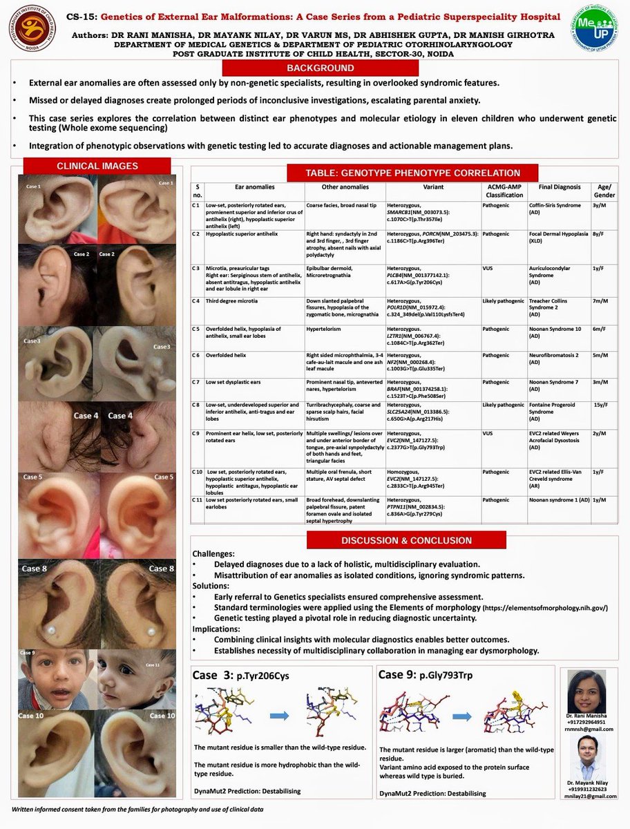 Medical Genetics PGICH Noida (@medgennoida) on Twitter photo Research work presented at #IAMG2024 conference, well appreciated by the International gathering <a href="/PGIChildHealth/">Post Graduate Institute of Child Health, Noida</a> <a href="/MeUPGovt/">Medical Education Uttar Pradesh</a> Research work presented at #IAMG2024 conference, well appreciated by the International gathering <a href="/PGIChildHealth/">Post Graduate Institute of Child Health, Noida</a> <a href="/MeUPGovt/">Medical Education Uttar Pradesh</a>