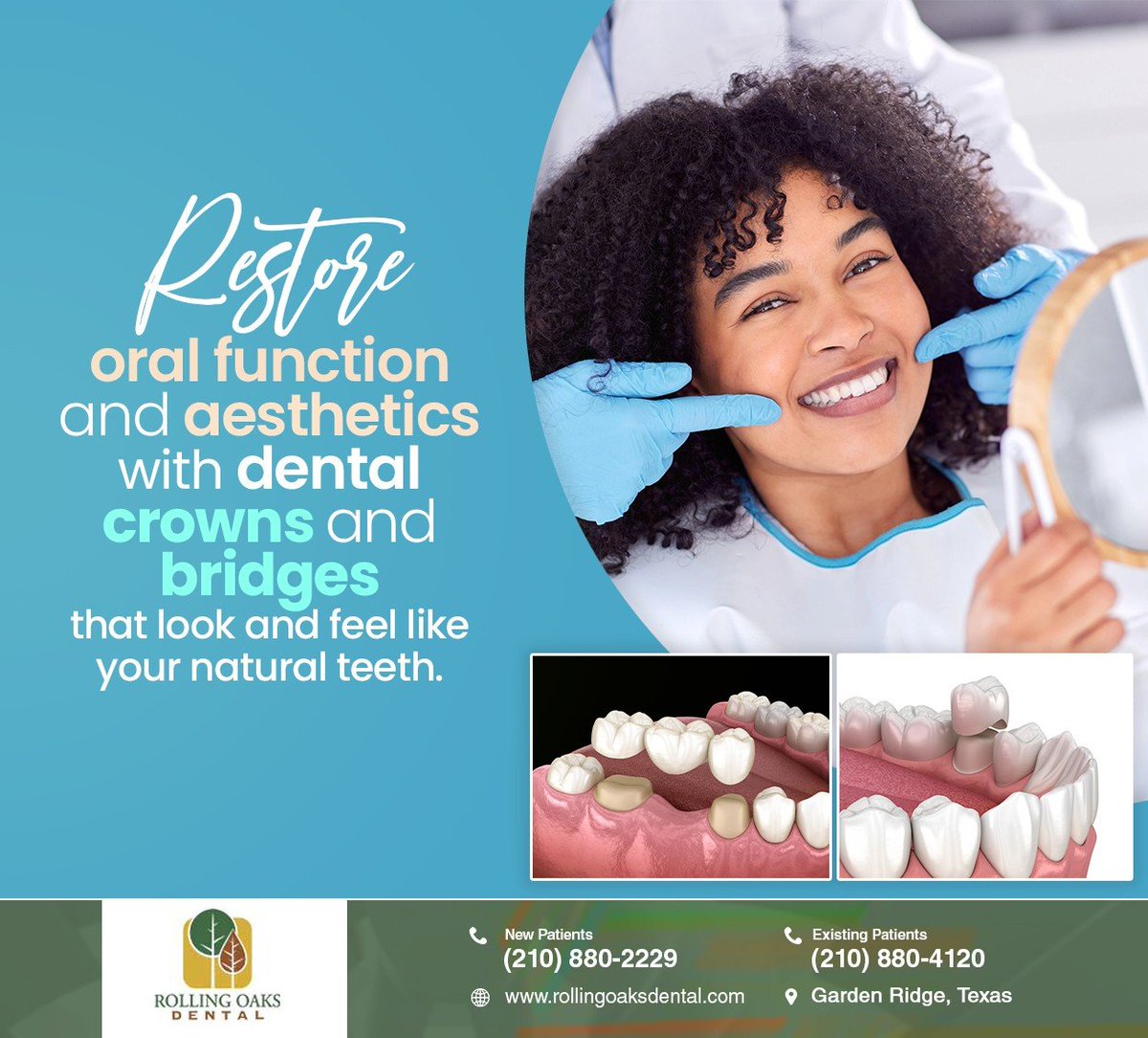 Damaged and missing teeth can affect your oral health. Dental crowns and bridges are a great option for rebuilding your smile and restoring your oral health. Learn more at rollingoaksdental.com #dentalcrown #dentalbridges #RollingOaksDental #GardenRidge #TX