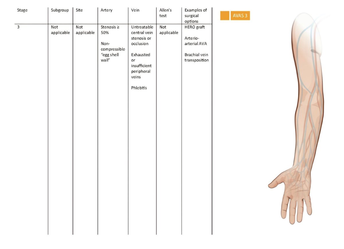 vasyoungcom's tweet photo. ➡️AVAS 2 patients are suitable for AV grafts, but unsuitable for native AV access. It is divided into 2 subgroups (A, B) which also correspond to the anatomic location (A – forearm, B – upper arm).
➡️AVAS 3 patients are not suitable for typical native or graft options. https://t.co/L0Hsc9W1js