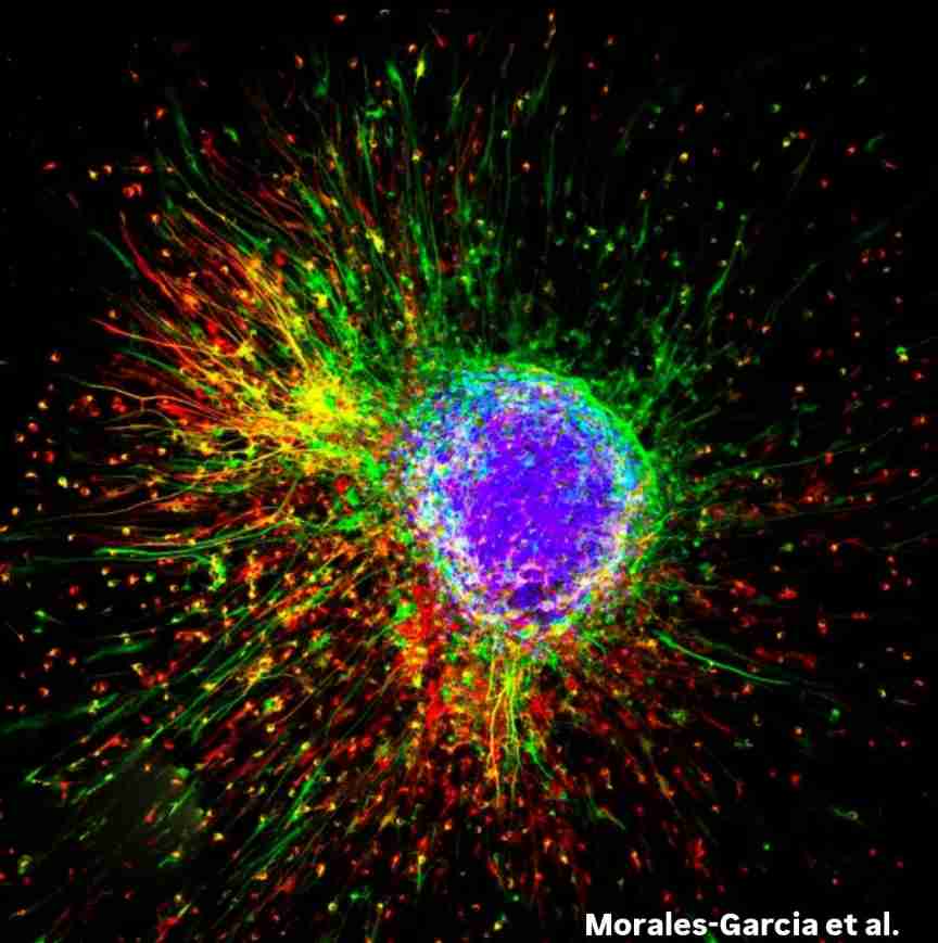 ¿Y si la estrella de Belén fuera en realidad una neuroesfera (esfera rica en células madre neurales)?

Mis mejores deseos para estas fiestas. Que la fluorescencia de esta neuroesfera os ilumine durante el 2025 a 499nm (azul), 566nm (verde) y 664nm (rojo).