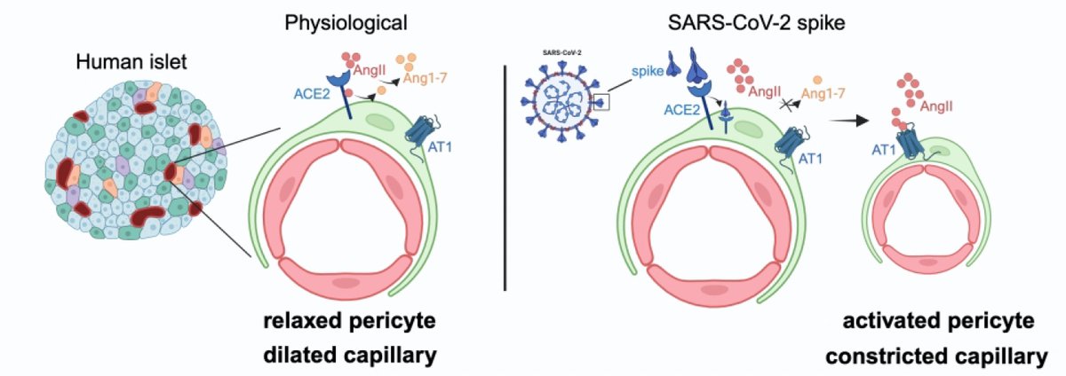 Covid is associated with an increased risk of Type 2 diabetes thelancet.com/journals/landi…
(one of many reports) 
But the mechanism is unclear. A new study suggests islet microvascular dysfunction is a contributing factor 
diabetesjournals.org/diabetes/artic… open-access