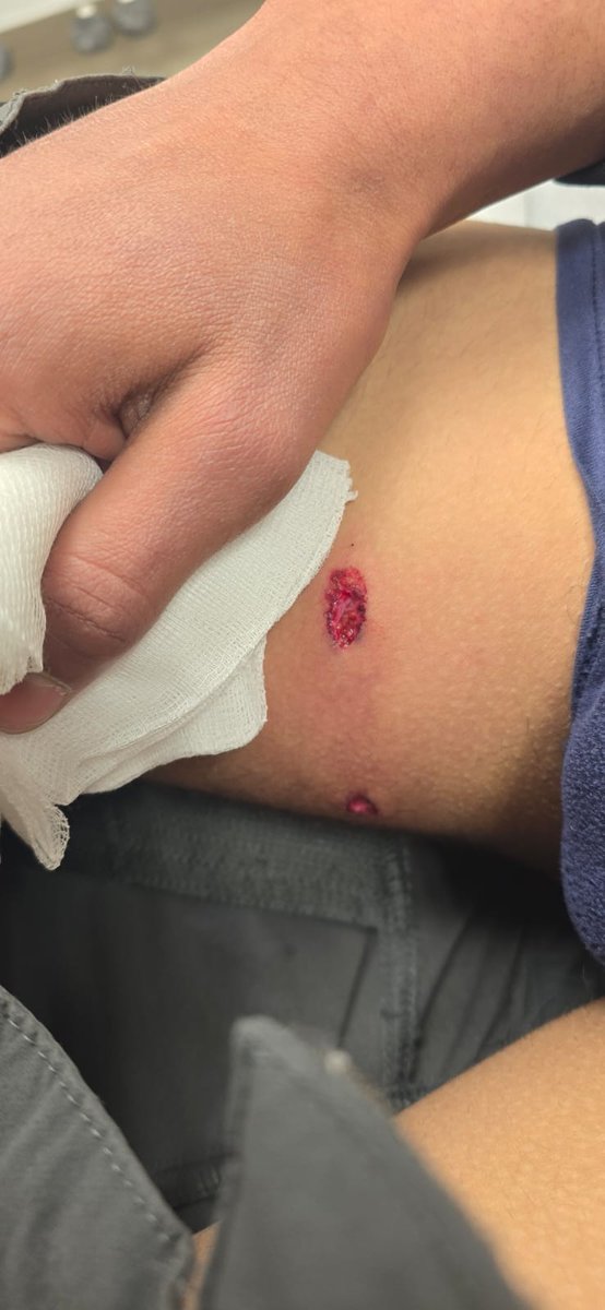 Human_Defenders's tweet photo. 16-year-old Palestinian boy was injured tonight in the Jabari neighborhood of Hebron after being shot by Israeli occupation soldiers.
إصابة فتى فلسطيني يبلغ من العمر 16 عاما هذه الليلة في حارة جابر في الخليل بعد إطلاق النار عليه من قبل جنود الاحتلال الإسرائيلي. https://t.co/40WwwOqXdq