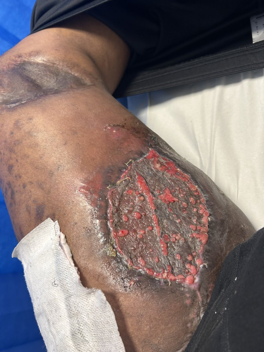 Ben Mcbean OFFICIAL tweet media