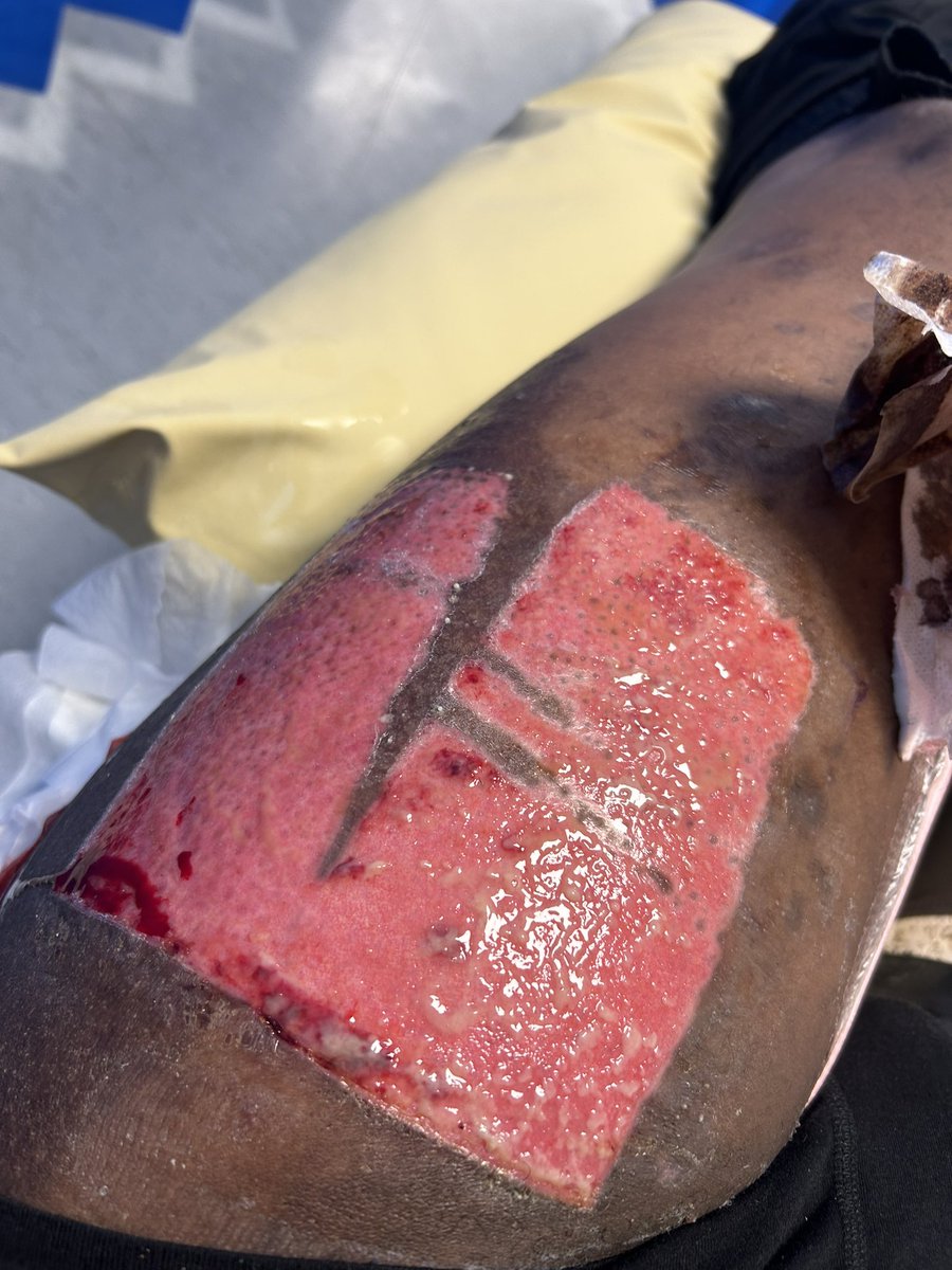 Ben Mcbean OFFICIAL tweet media