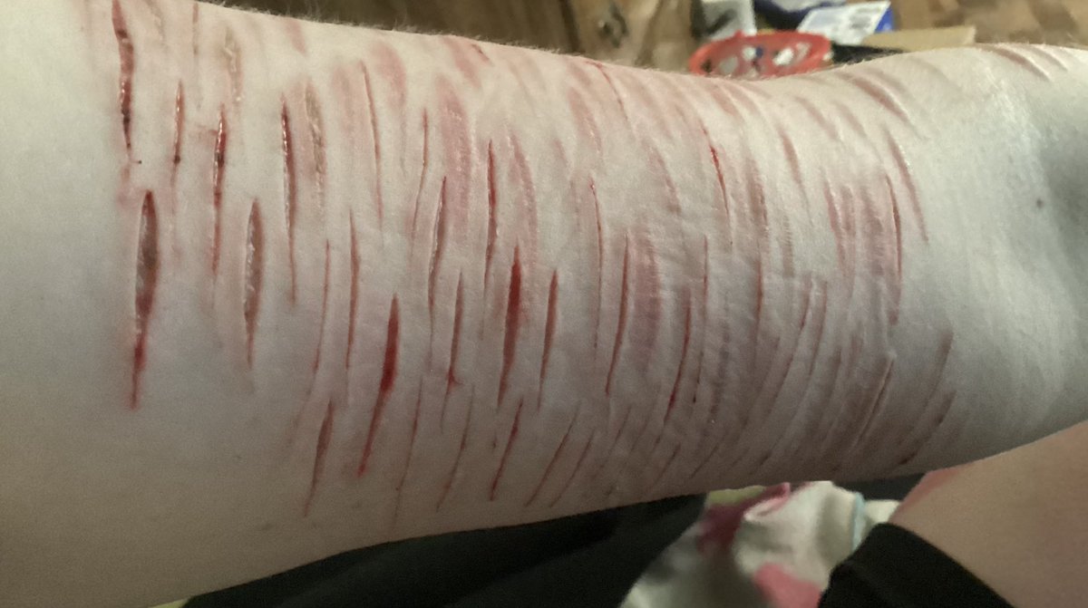 Pezshtwt's tweet photo. These hurt like absolute hell in the shower- #shtwt #sh #slitwt #slittwt #cvts #cuts #ouchietwt #ouchie #988twt #styros #styrofoam #deepstyros #babybeans https://t.co/ii8h35a0FQ
