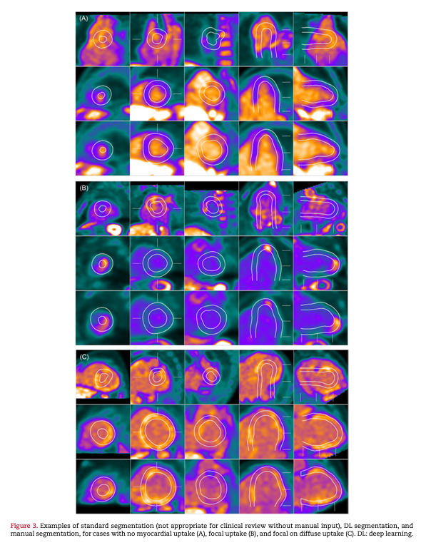 Journal of Nuclear Cardiology tweet media