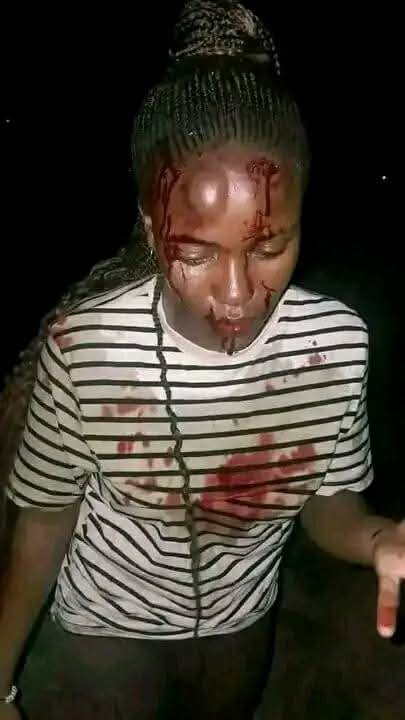 #ደብረ_ብርሃን_ዩኒቨርሲቲ አሸባሪውን የኦሮሞ ሥርዓት ሊያወግዙ የወጡ የዩኒቨርስቲ ተማሪዎች እየተጨፈጨፉና እንግልት እንዲሁም አስገድዶ መድፈር እየደረሰባቸው መሆኑን ዛሬ ከዩኒቨርስቲው ያገኘነው መረጃ ያመለክታል!

#WarOnAmhara 
#WarOnWomen