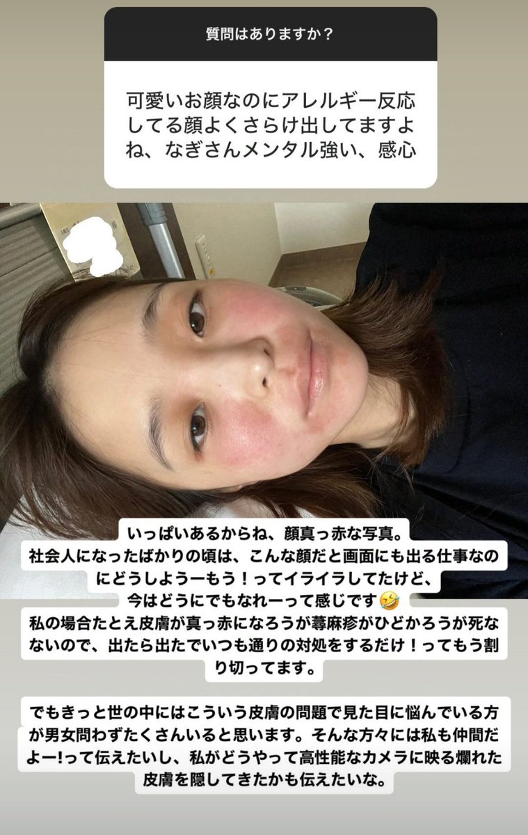 【🚨文春砲！加害者＝中居正広と言われていた】
中居正広9000万円SEXスキャンダルの文春砲では、20代女性X子さんは中居正広を加害者と言ってた

松本人志氏との関連性は？？🤔

【詳細】
・女性セブン：3人のうち編成幹部A氏のみ欠席
・文春：A氏を含めた大人数で食事と言われていた
↓