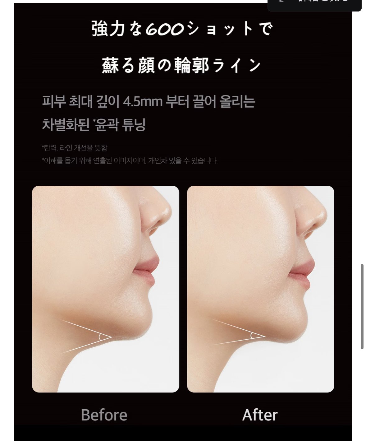 Medicube ハイフォーカスショット c9380c0bcdde40a8a28106b98cfd6e