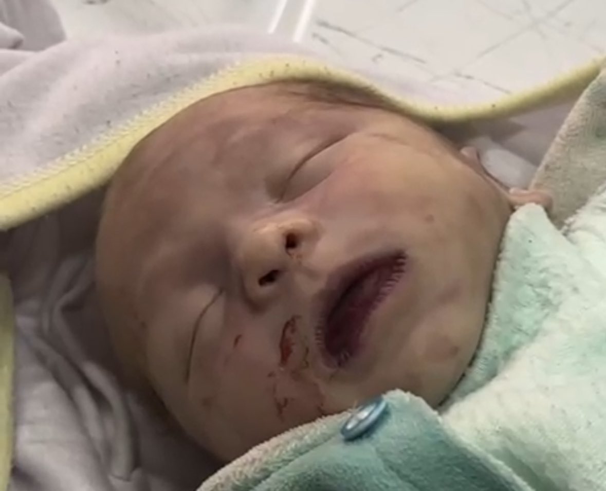 In her cold tent in Mawasi Khan Younis, the infant Sila Al-Fasih passed away due to extreme cold, becoming the second child to die within a week. Sila, who knew nothing of the world except her mother’s embrace and a fragile blanket, left us as a reminder of a people’s silent