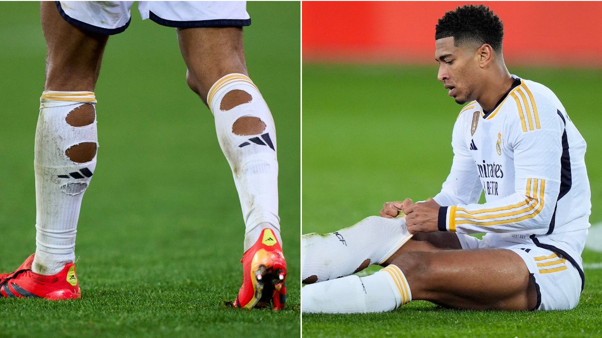 wintipscom1's tweet photo. Football Players and the Mystery of Holey Socks
In recent years, football fans may have noticed an interesting trend on the field: many players cut holes in their game socks.
See more: https://t.co/Ha5T4CtZnT https://t.co/7f2vUtA3sj