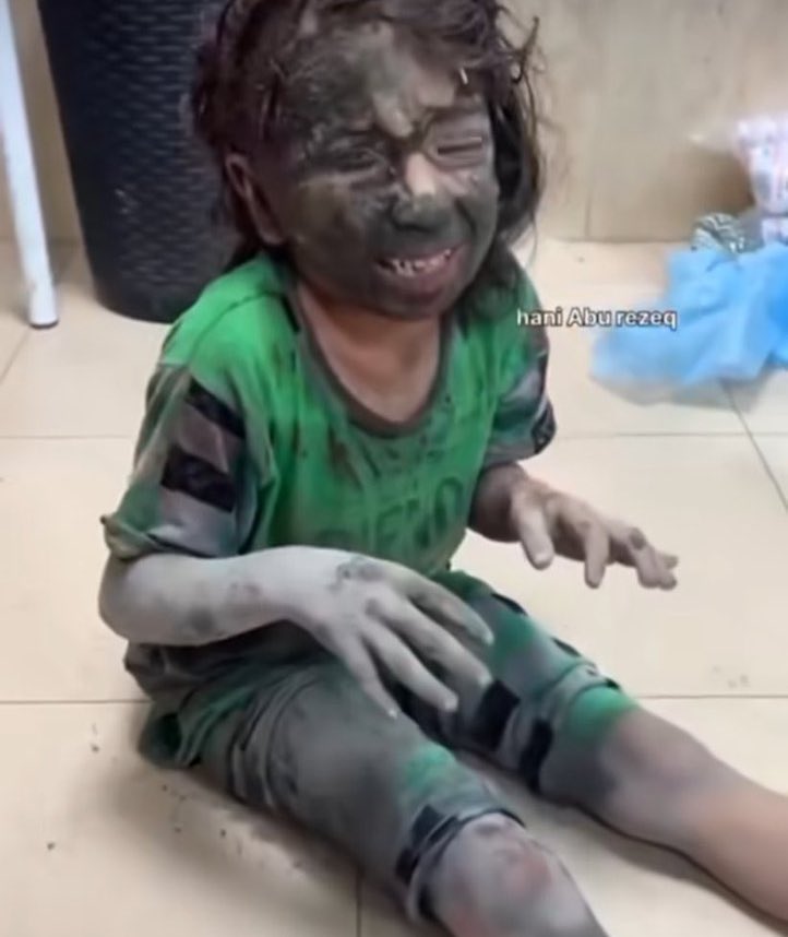 If you see this pic, Reply with 🇵🇸 to spread it! 💔