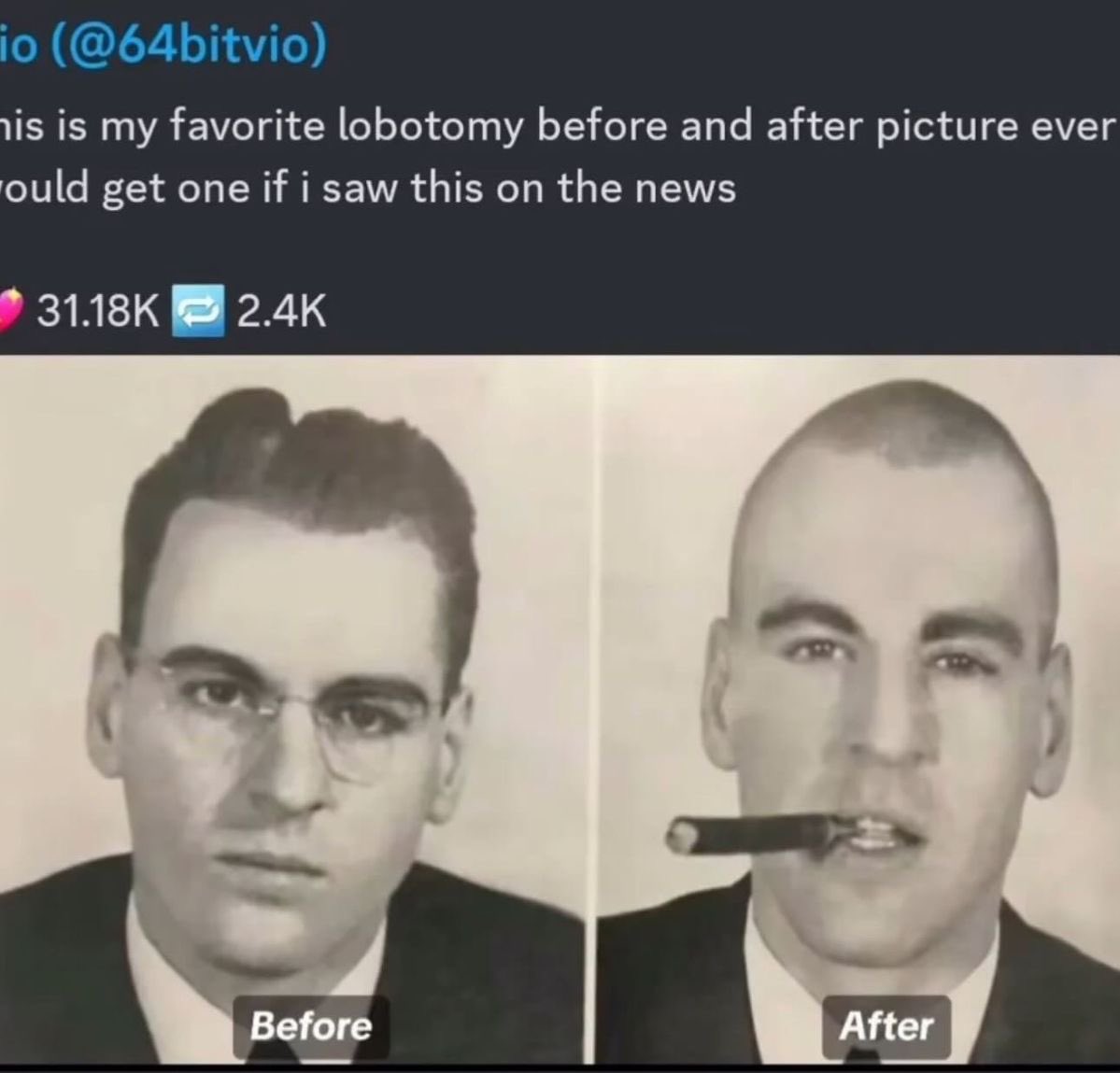 amishtech_xo's tweet photo. @thedollop @reynoldsgareth @daveanthony What people don��t know about lobotomies is they had a 15% chance of making you cool as fuck. https://t.co/E88SE0vnBC