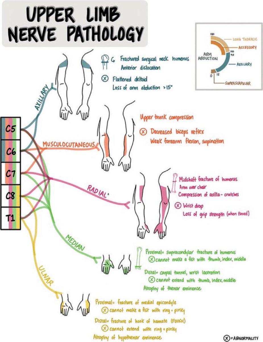 Omid_HopeUni's tweet image. Upper Limb Nerve Pathology

#nerve #upperlimb

neurology.org/doi/10.1212/NE…