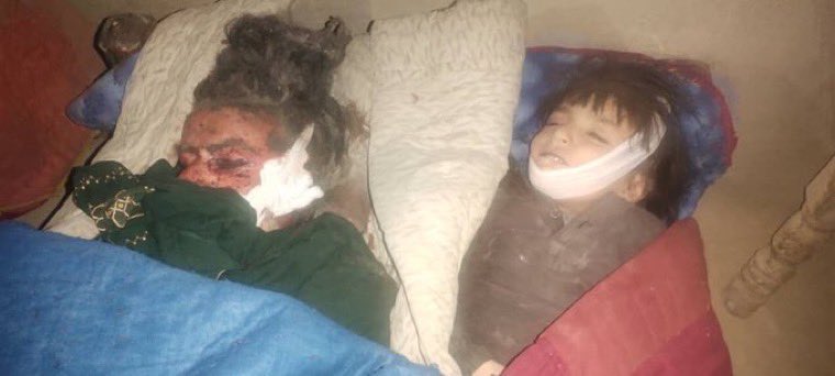 L.M (@pgtanalytics) on Twitter photo 🔥 News Alert 🔥
The Pakistan military and air force have carried out indiscriminate bombardments in Afghanistan Paktika province, resulting in multiple casualties, including the tragic deaths of 46 children.
<a href="/realZalmayMK/">Zalmay Khalilzad</a> 🔥 News Alert 🔥
The Pakistan military and air force have carried out indiscriminate bombardments in Afghanistan Paktika province, resulting in multiple casualties, including the tragic deaths of 46 children.
<a href="/realZalmayMK/">Zalmay Khalilzad</a>