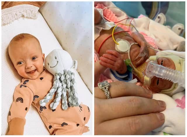 Baby Born at 25 Weeks Heads Home for Christmas After Miracle Recovery buff.ly/3WJdrVE