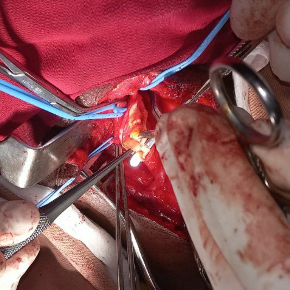 Feron Getachew/ፈርኦን tweet media