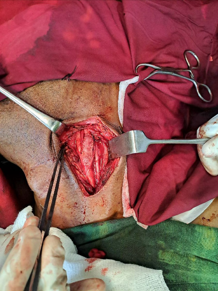 Feron Getachew/ፈርኦን tweet media