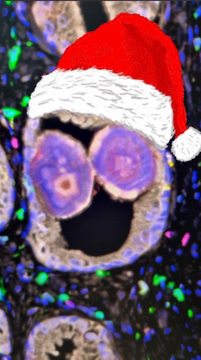 Wishing everyone a happy and healthy holiday season!
Stay warm and enjoy this special time with your loved ones!

#pathart #pathX #Pathology #corporaamylacea