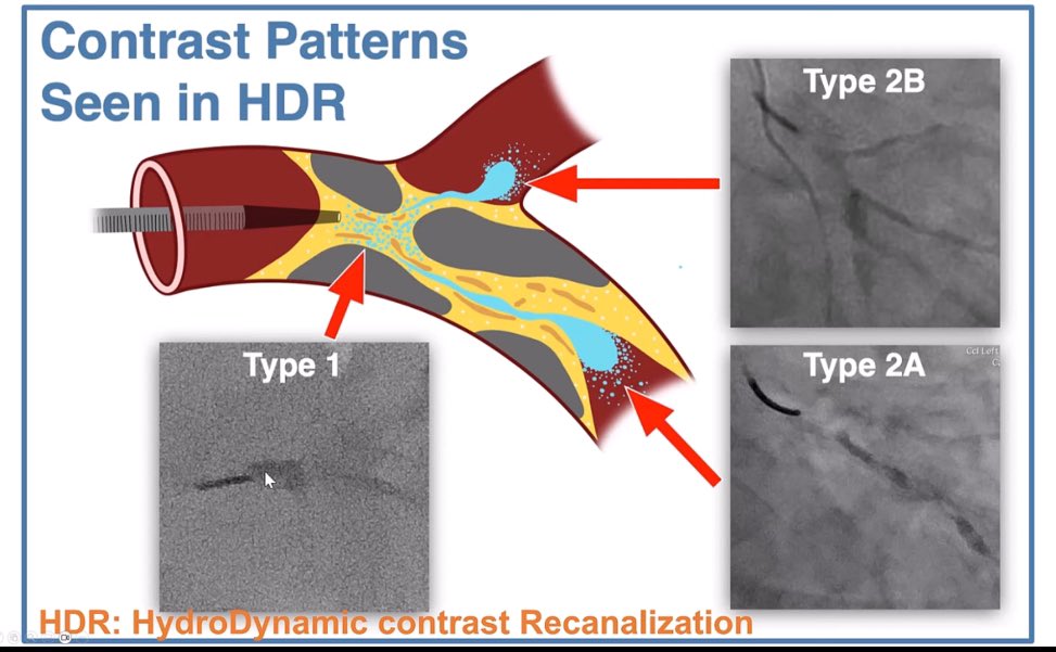 Arnav Kumar, MD, MSCR tweet media
