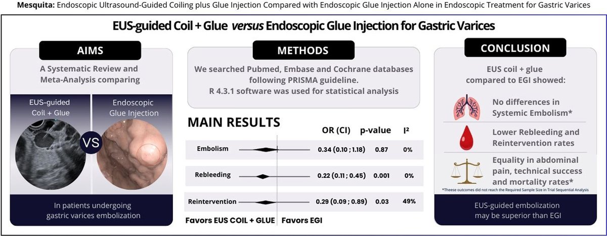 Do you treat gastric varices with EUS?

I invite you to check our recently published meta-analysis on this topic. "EUS-guided coiling plus glue injection compared with endoscopic glue injection"

sciencedirect.com/science/articl…