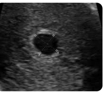 Mi92307Paul's tweet photo. @Boss_Ladee_ @tashad664 #traceybarbie just face the fact that you are sterile asf and since I know u will never get pregnant this is what a 4 wk sonogram looks like….they are required to measure bc that determines the due date and etc. Try another fake one in another 2 yrs when u are 32 yrs old😂😂 https://t.co/aQjwyBYJVn