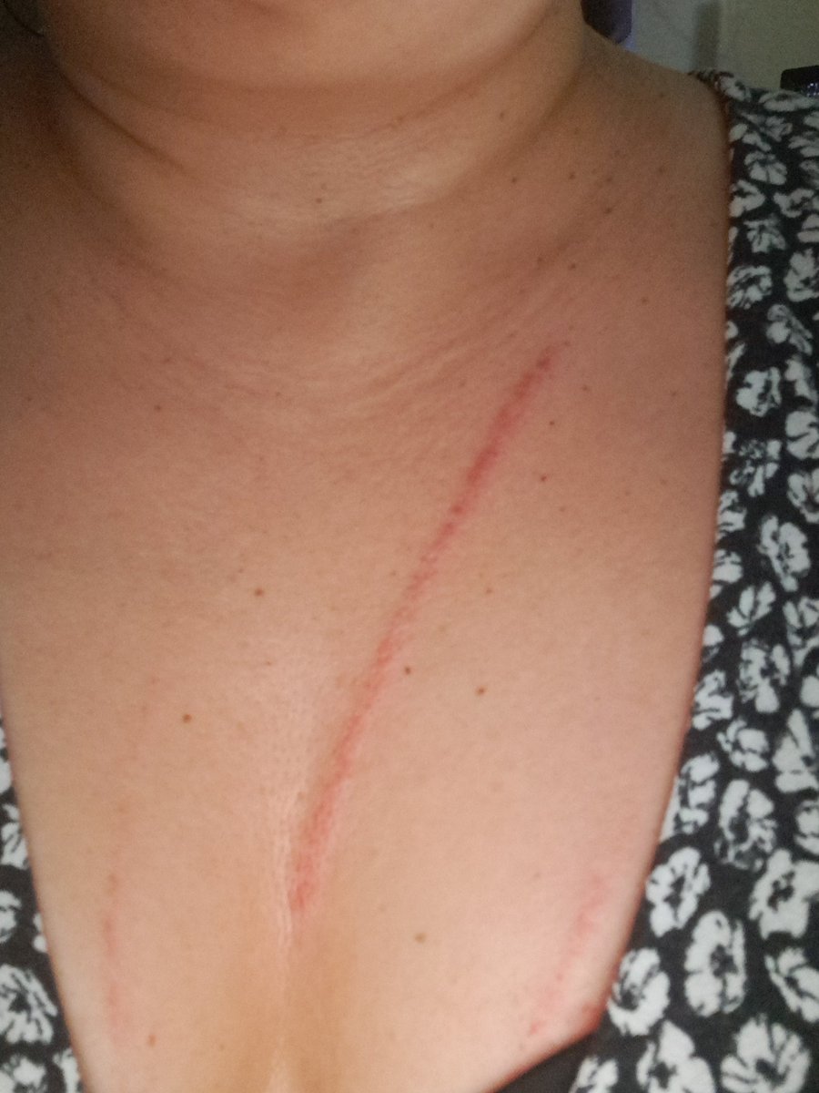 MaryJane_Seven's tweet photo. Sres. @ECU911_ @DanielNoboaOk lo que temía y fue anunciado en denuncias. Ya me agredieron y amenazaron los inquilinos de la casa contigua a la mía, gente que vive y hace vivir mal. Llamo y no hay respuesta de ayuda hasta ahora @bessygranjaOK @LeoFloresMoreno @DEFENSORIAEC https://t.co/flDC7e79Th