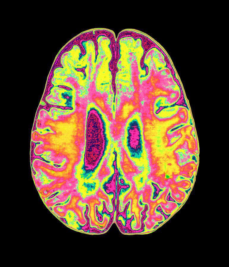 DivineManhood's tweet photo. Your attention span is non-existent.

99% of people can’t focus because their brains are fried.

Andrew Huberman has a secret 17-minute method that can rewire your brain in just one session.

Here’s exactly how you can do it 🧵: https://t.co/U3UVGwnNeY