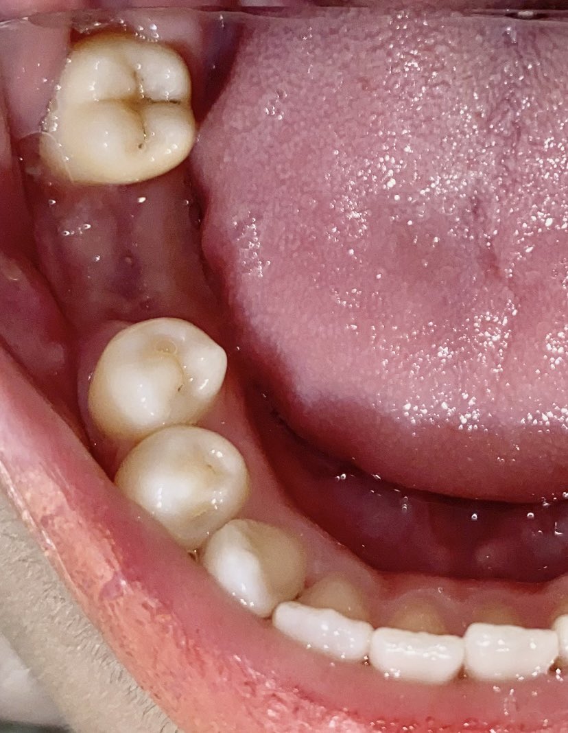 Koas Gigi Jogja tweet media