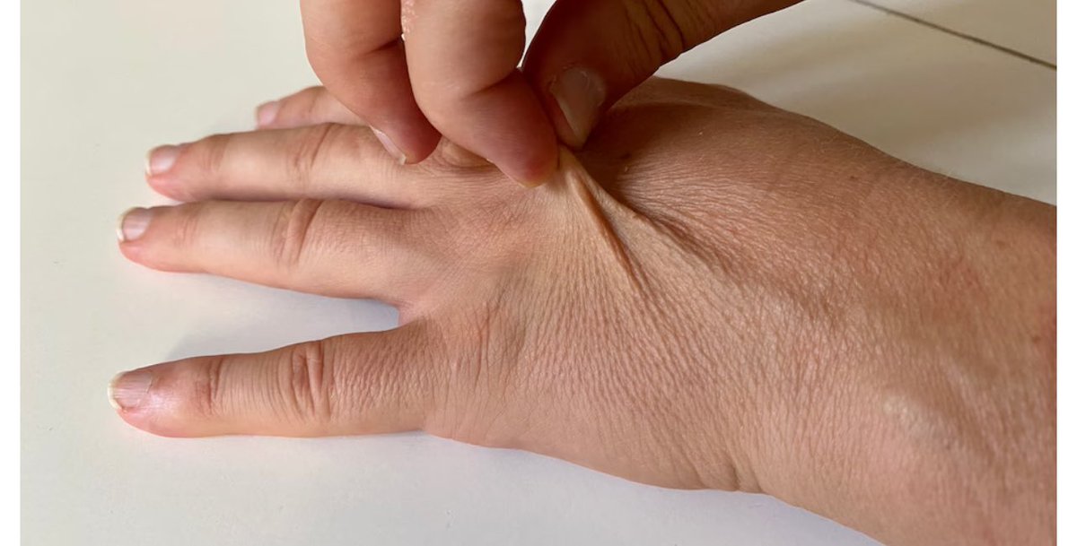 XEAOOO's tweet photo. @haberebibak Kesinlikle yanlış bilgi parmaktan test yapılmaz, elinin üstünden yapılır!! https://t.co/MAiuQQIybi
