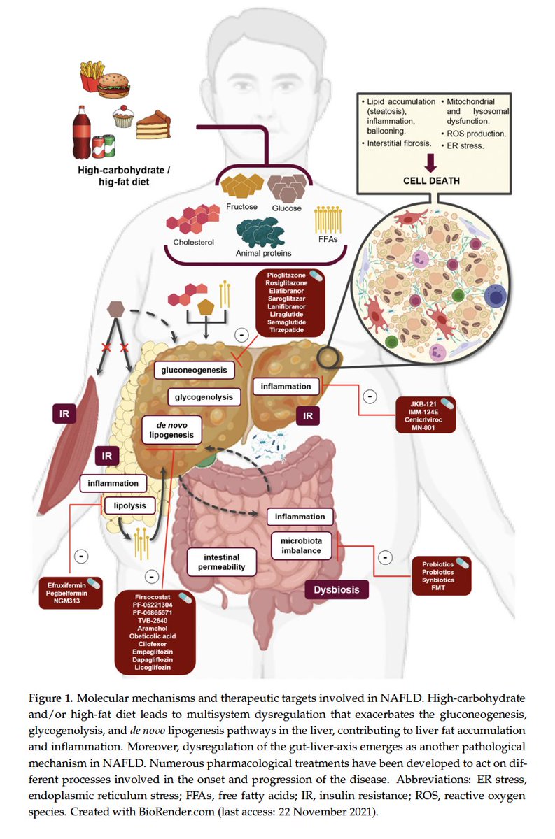 #MASLD isn't one-size-fits-all! New review unveils molecular subtypes, highlighting the urgent need for tailored therapies. The future of liver health is precision medicine.
<a href="/DraMartaAlonsoP/">Marta Alonso Peña, PhD</a> <a href="/PIruzubieta/">Paula Iruzubieta</a> <a href="/InmunoHUMV/">InmunoValdecilla</a> <a href="/HUnivValdecilla/">Hospital Universitario Marqués de Valdecilla</a>