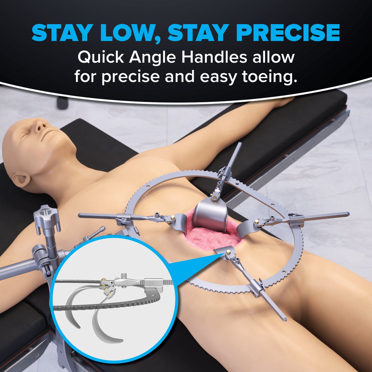 ThompsonRetract's tweet image. Thompson’s Quick Angle Handles make adjusting your blades effortless. With a 45-degree toeing range and a low-profile design, the angling mechanism stays at the head—keeping handles out of your way while ensuring precise retraction. 🔧✅ #ThompsonRetractor #SurgicalInnovation