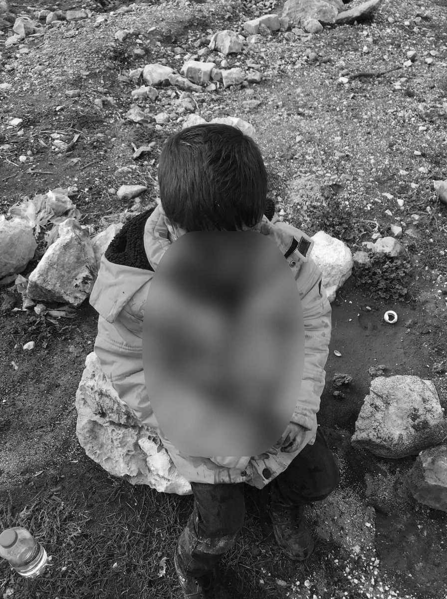 Adıyaman'da okuldan eve dönerken başıboş köpeklerin saldırısına uğrayan 9 yaşındaki çocuk ağır yaralandı. 

Acil ameliyata alınan çocuğun durumu ciddiyetini koruyor.

tr.trthaber.com/1/41c2eaf3