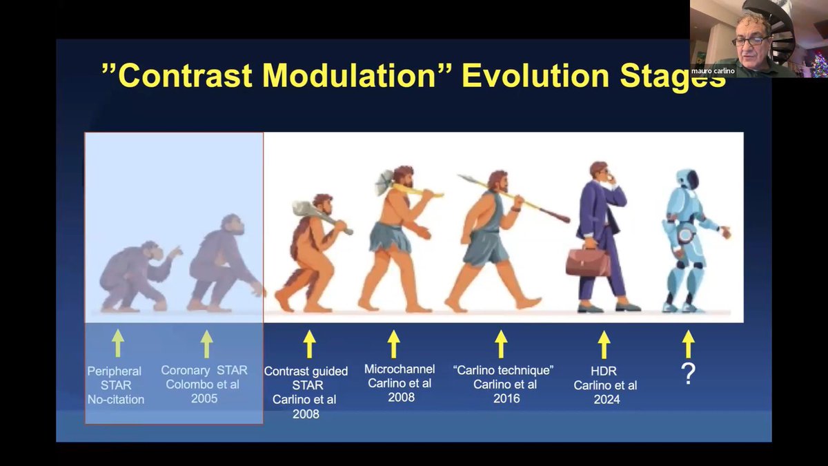 Salman Arain (@realarainmd) on Twitter photo The evolution of contrast modulation is discussed in our paper!
<a href="/MauroCarlino3/">Mauro Carlino</a> gave a great lecture about his journey at the Western Canada CTO rounds. <a href="/DrBIqbal/">Bilal Iqbal</a> posted the recording on YouTube.
Here is the link: youtu.be/_S81-H9XX68
Happy viewing! We look forward to The evolution of contrast modulation is discussed in our paper!
<a href="/MauroCarlino3/">Mauro Carlino</a> gave a great lecture about his journey at the Western Canada CTO rounds. <a href="/DrBIqbal/">Bilal Iqbal</a> posted the recording on YouTube.
Here is the link: youtu.be/_S81-H9XX68
Happy viewing! We look forward to