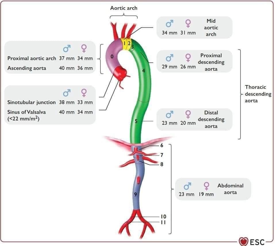 🔴Normal Aortic Values ⤵️ #Echofirst #Pocus

 #Cardiology #FOAMed #MedEd #medstudent #paramedic #Cardiology #CardioEd #medtwitter #meded #CardioTwitter #cardiotwiteros  #MedX #cardiovascular #MedTwitter #medical #medEd #cardiotwitter #medicineball