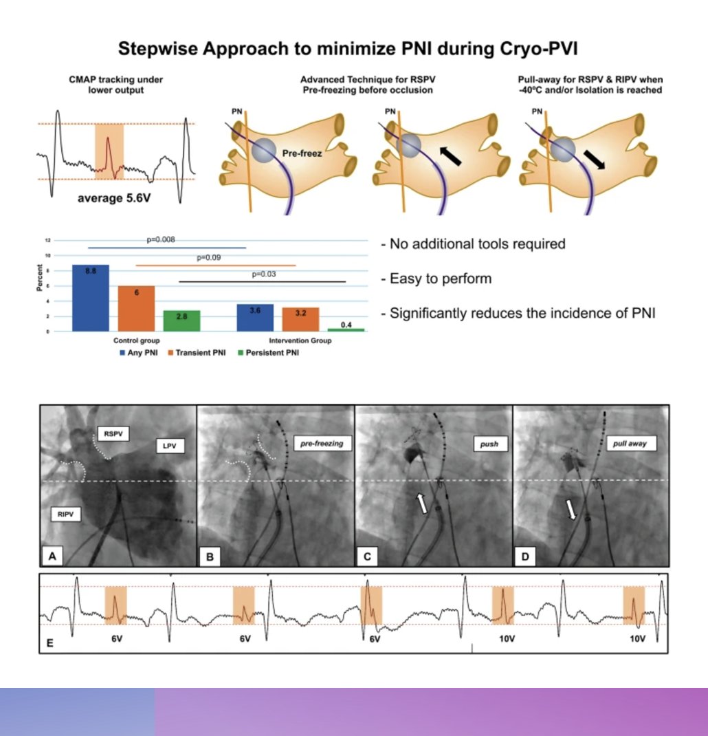 JICE (@jice_ep) on Twitter photo Latest #OpenAccess Article in
<a href="/JICE_EP/">JICE</a>
A New Stepwise Approach to Minimize Phrenic Nerve Injury during Cryoballoon Pulmonary Vein Isolation
📖🧐 rdcu.be/d4TVE
doi.org/10.1007/s10840…
by K. Phkhaladze, H. Omran, T. Fink, <a href="/VanessaSciacca_/">Vanessa Sciacca</a>, D. Guckel, <a href="/MoneebKhalaph/">Moneeb Khalaph</a>, M. Latest #OpenAccess Article in
<a href="/JICE_EP/">JICE</a>
A New Stepwise Approach to Minimize Phrenic Nerve Injury during Cryoballoon Pulmonary Vein Isolation
📖🧐 rdcu.be/d4TVE
doi.org/10.1007/s10840…
by K. Phkhaladze, H. Omran, T. Fink, <a href="/VanessaSciacca_/">Vanessa Sciacca</a>, D. Guckel, <a href="/MoneebKhalaph/">Moneeb Khalaph</a>, M.